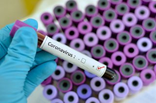 Оксана Макарук: "У ситуації з коронавірусом найголовніше зараз дотримуватися рекомендацій ВООЗ"